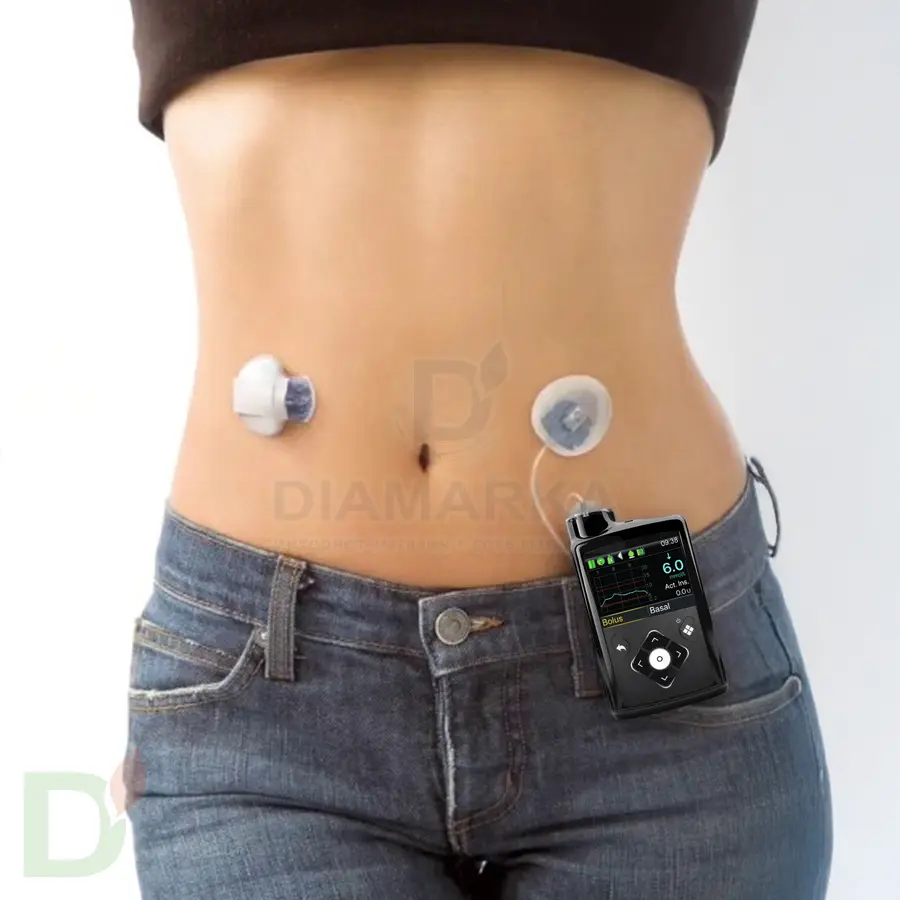 Инсулиновая помпа Medtronic MiniMed 720G MMT-1859
