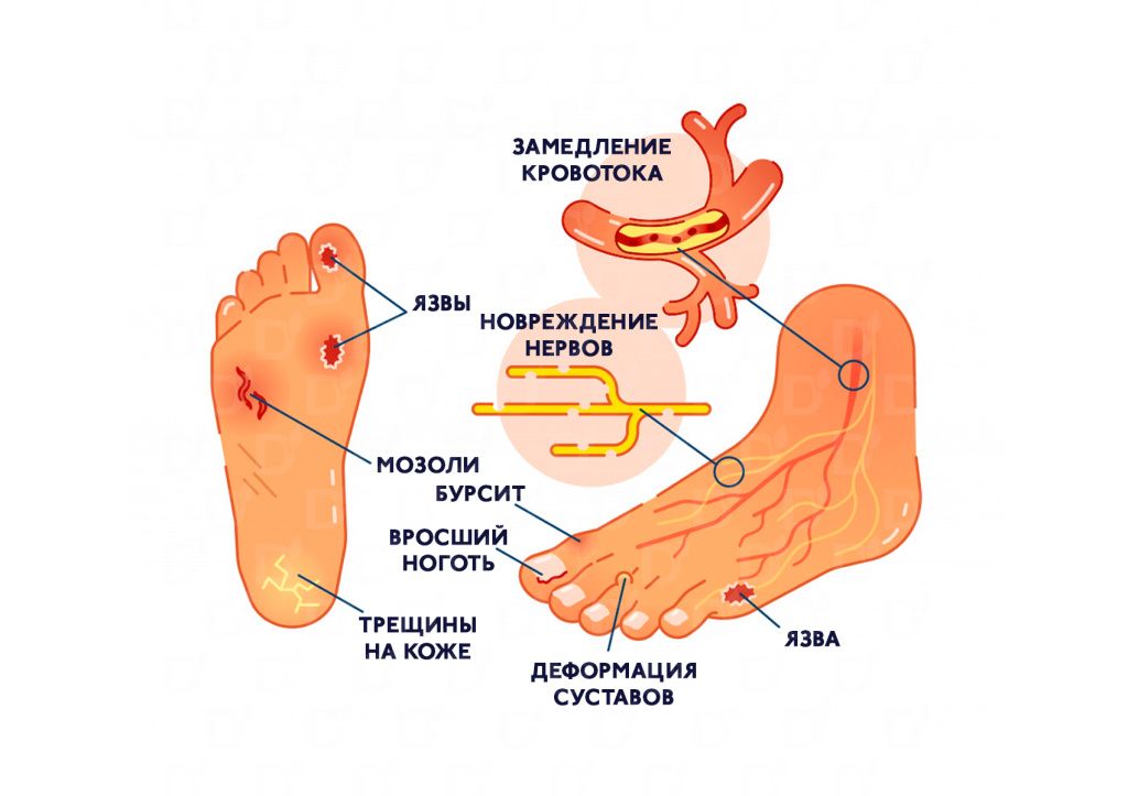 стопа-4.jpg стопа-4.jpg
