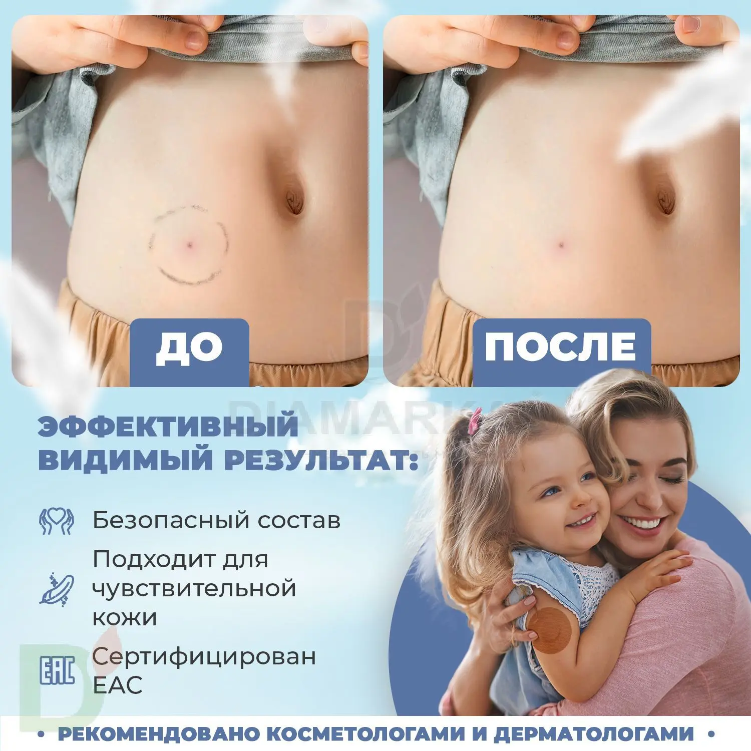 Ремувер 4SKINcare гипоалергенный Без отдушки, 115 мл